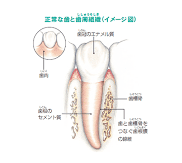 歯周病はどうして起こるの？